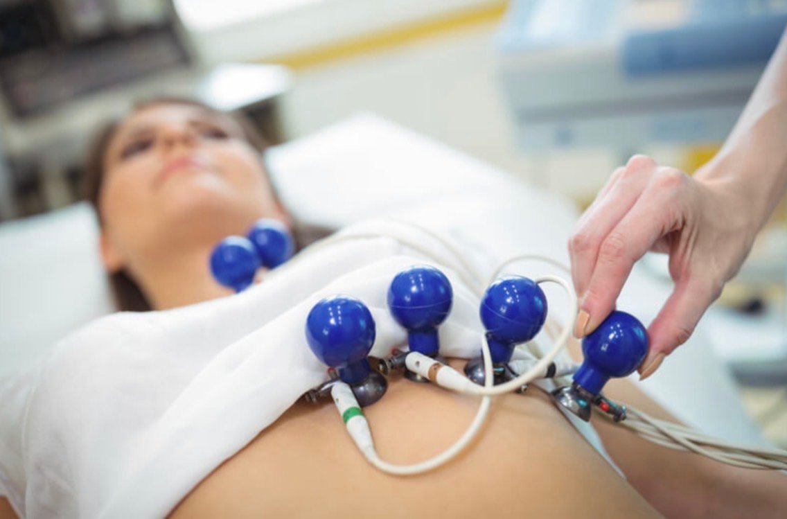 Eletrocardiograma — eletrodos posicionados sobre o tórax